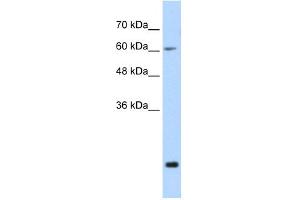 WB Suggested Anti-FUS Antibody Titration:  0. (FUS anticorps  (N-Term))