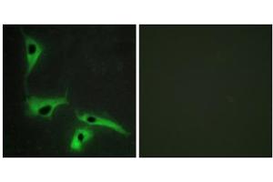 Immunofluorescence analysis of HeLa cells, using TSPAN8 antibody.