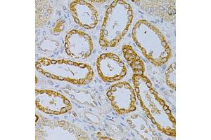 Immunohistochemistry of paraffin-embedded human kidney using OLR1 Antibody. (OLR1 anticorps)