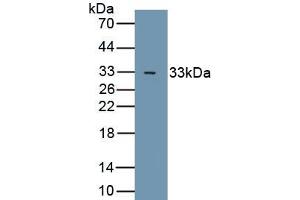 Detection of Recombinant GSK3b, Human using Polyclonal Antibody to Glycogen Synthase Kinase 3 Beta (GSK3b) (GSK3 beta anticorps  (AA 122-375))