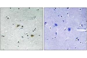 Immunohistochemistry analysis of paraffin-embedded human brain, using Src (Phospho-Ser75) Antibody.