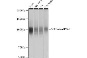 Western blot analysis of extracts of various cell lines, using SERC/ Rabbit mAb (ABIN7265753) at 1:1000 dilution. (ATP2A2 anticorps)