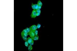 IF analysis of Ataxin 1 using anti-Ataxin 1 antibody (ABIN3043506). (Ataxin 1 anticorps  (C-Term))