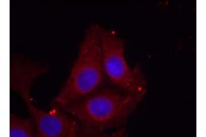 Immunofluorescence staining of methanol-fixed HeLa cells using GAP43 (Phospho-Ser41) Antibody (E011281, Red) (GAP43 anticorps  (pSer41))