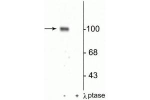 Western blot of rat hippocampal lysate showing specific immunolabeling of the ~100 kDa GluR1 protein phosphorylated at Ser845 in the first lane (-). (Glutamate Receptor 1 anticorps  (pSer845))