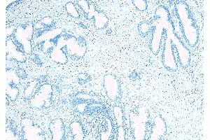 anti-Tumor Suppressor Candidate 3 (TUSC3) (Internal Region) antibody