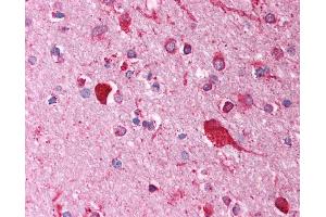 Anti-FOXI1 antibody IHC of human brain, cortex.