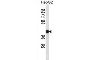Western Blotting (WB) image for anti-Epidermal Retinal Dehydrogenase 2 (RDHE2) antibody (ABIN2998329) (SDR16C5 anticorps)