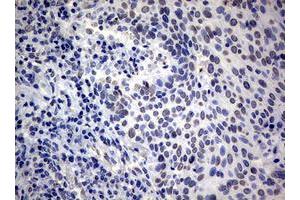 Image no. 5 for anti-RAS Guanyl Releasing Protein 3 (Calcium and DAG-Regulated) (RASGRP3) (AA 380-690) antibody (ABIN1491477)