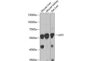Western blot analysis of extracts of various cell lines, using L antibody (ABIN6131434, ABIN6143087, ABIN6143088 and ABIN6222907) at 1:1000 dilution. (LAP3 anticorps  (AA 260-519))