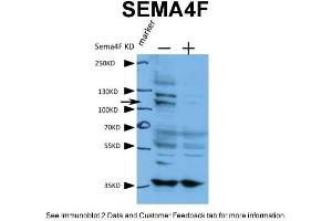 human cell line A431 Primary antibody dilution and incubation time:1:600, 4 degree overnightSecondary antibody used and dilution and incubation time: 1:3000, RT 2 hours (SEMA4F anticorps  (N-Term))