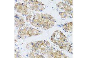 Immunohistochemistry of paraffin-embedded human stomach using FGF13 antibody. (FGF13 anticorps  (AA 1-245))