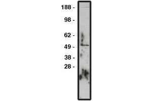 Western blot using GLI1 antibody , used  at 1:200k dilution. (GLI1 anticorps)