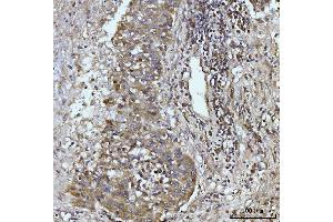 IHC analysis of Glutaminase/GLS using anti-Glutaminase/GLS antibody (ABIN7601602). (Glutaminase anticorps  (AA 396-654))