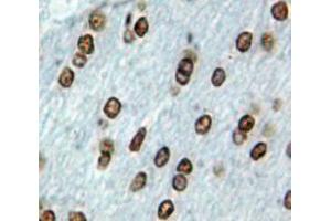 Used in DAB staining on fromalin fixed paraffin-embedded Brain tissue