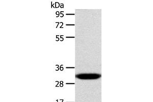 Western Blot analysis of Human fetal liver tissue using CCS Polyclonal Antibody at dilution of 1:300 (Superoxide dismutase copper chaperone anticorps)