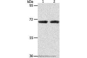 Western blot analysis of Human liver cancer and fetal kidney tissue, using ACOT11 Polyclonal Antibody at dilution of 1:650 (ACOT11 anticorps)