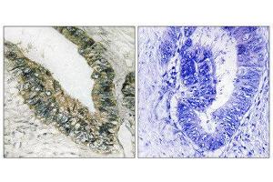 Immunohistochemistry (IHC) image for anti-Eukaryotic Translation Initiation Factor 2-alpha Kinase 3 (EIF2AK3) (Thr981) antibody (ABIN1848258) (PERK anticorps  (Thr981))