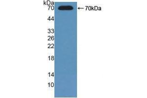 Western blot analysis of recombinant Mouse ADK. (ADK anticorps  (AA 1-361))