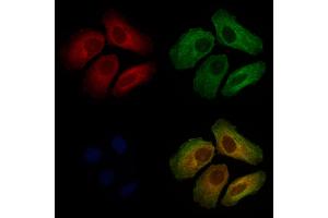ABIN7093938 and ABIN7097982 staining Hela cells by IF/ICC. (OSBPL2 anticorps  (C-Term))