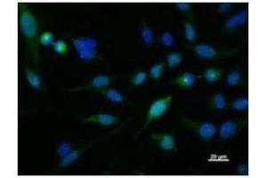 Immunostaining analysis in HeLa cells.