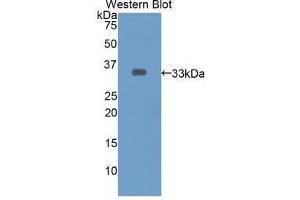 Western blot analysis of the recombinant protein. (ECE1 anticorps  (AA 469-721))