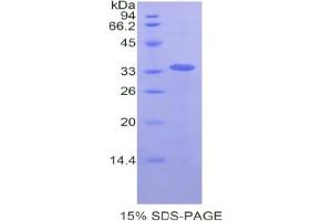 SDS-PAGE analysis of Human LOXL4 Protein. (LOXL4 Protéine)