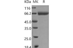 Western Blotting (WB) image for Bone Marrow Stromal Cell Antigen 1 (BST1) protein (Fc Tag) (ABIN7321111)