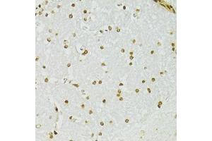Immunohistochemistry of paraffin-embedded mouse brain using ADAR antibody.