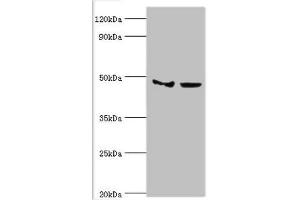 Western blot All lanes: Histone-lysine N-methyltransferase SMYD3 antibody at 3 μg/mL Lane 1: Hela whole cell lysate Lane 2: HepG2 whole cell lysate Secondary Goat polyclonal to rabbit IgG at 1/10000 dilution Predicted band size: 50, 30, 43 kDa Observed band size: 50 kDa (SMYD3 anticorps  (AA 199-428))