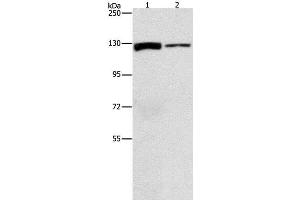 Western Blot analysis of A172 and PC3 cell using ACLY Polyclonal Antibody at dilution of 1:1050 (ACLY anticorps)