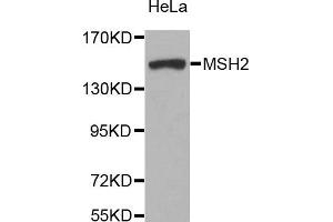 Western blot analysis of extracts of HeLa cell line, using MSH2 antibody.