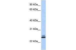 JAZF1 antibody used at 0. (JAZF1 anticorps  (N-Term))