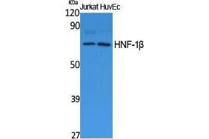 Western Blotting (WB) image for anti-HNF1 Homeobox B (HNF1B) (N-Term) antibody (ABIN3187643)