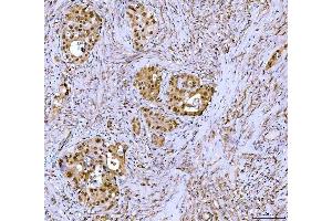 IHC analysis of Symplekin/SYMPK using anti-Symplekin/SYMPK antibody (ABIN7601558). (Symplekin anticorps  (AA 384-1092))