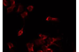 ABIN6274821 staining Hela by IF/ICC. (AGXT2L2 anticorps  (C-Term))