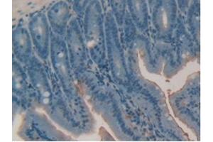 Detection of RARa in Mouse Intestine Tissue using Polyclonal Antibody to Retinoic Acid Receptor Alpha (RARa) (Retinoic Acid Receptor alpha anticorps  (AA 237-459))