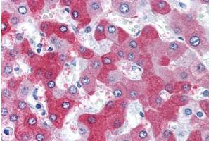 Human Liver (formalin-fixed, paraffin-embedded) stained with FTCD antibody ABIN351476 at 3. (FTCD anticorps  (AA 2-17))