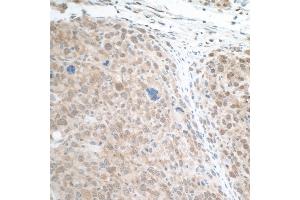 Immunohistochemistry (IHC) image for anti-Signal Transducer and Activator of Transcription 3 (Acute-Phase Response Factor) (STAT3) (AA 175-225) antibody (ABIN7455098)