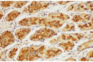Immunohistochemistry of paraffin-embedded Human stomach using ST14 Ployclonal Antibody at dilution of 1:100. (ST14 anticorps)