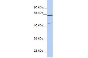WB Suggested Anti-CCDC74A Antibody Titration: 0. (CCDC74A anticorps  (Middle Region))
