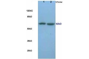 L1 rat lung lysates, L2 rat brain lysates probed (ABIN681853) Anti-Frizzled-5 Polyclonal, Unconjugated at 1:200 in 4 °C. (Frizzled5/8 anticorps  (AA 51-150))
