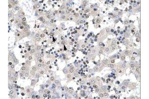 Image no. 1 for anti-Zinc Finger Protein 654 (ZNF654) (AA 289-338) antibody (ABIN6735934)