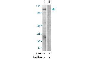 Western blot analysis of extracts from HUVEC cells, treated with PMA (125 ng/mL, 30 mins), using PRKD1 polyclonal antibody . (PKC mu anticorps  (Ser205))