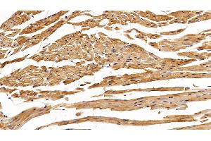 Detection of SOD1 in Mouse Cardiac Muscle Tissue using Polyclonal Antibody to Superoxide Dismutase 1 (SOD1) (SOD1 anticorps  (AA 2-154))