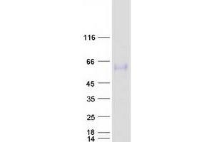 Validation with Western Blot