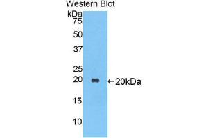 Western Blotting (WB) image for anti-serpin Peptidase Inhibitor, Clade A (Alpha-1 Antiproteinase, Antitrypsin), Member 1 (SERPINA1) (AA 27-181) antibody (ABIN1077773) (SERPINA1 anticorps  (AA 27-181))