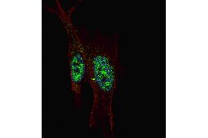 Fluorescent confocal image of SY5Y cells stained with STAT3 (C-term ) antibody.