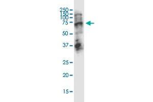 STAU2 monoclonal antibody (M01), clone 5C5.