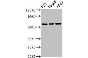 Western Blot Positive WB detected in: PC-3 whole cell lysate, HepG2 whole cell lysate, A549 whole cell lysate All lanes: vnn1 antibody at 3. (VNN1 anticorps  (AA 97-197))